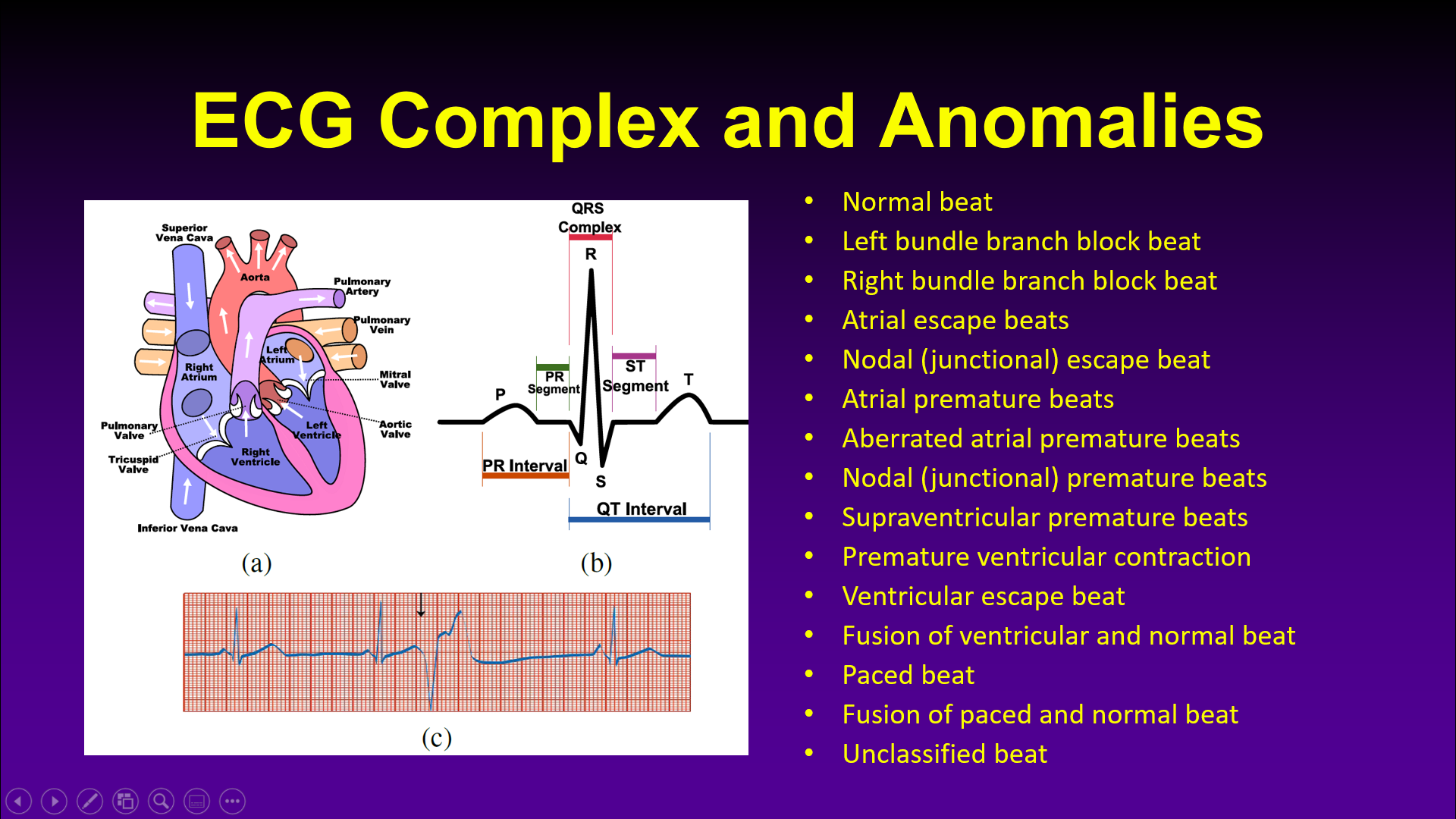 Continuous Heart Anomaly Detection System with Motion Artifacts ...