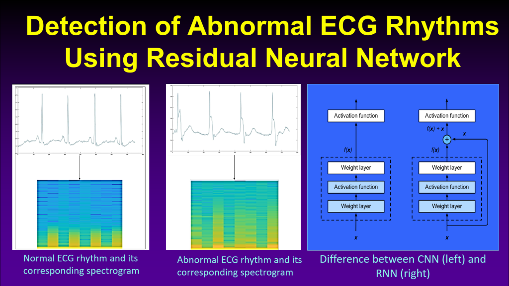 Continuous Heart Anomaly Detection System with Motion Artifacts ...
