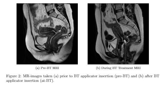 Female pelvis - Servier Medical Art